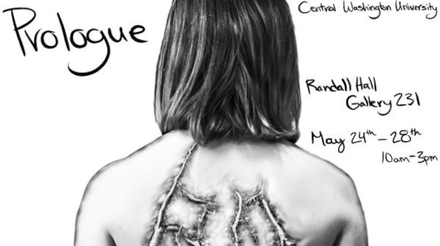 Emily Boyd uses cyanotype prints to document her healing process