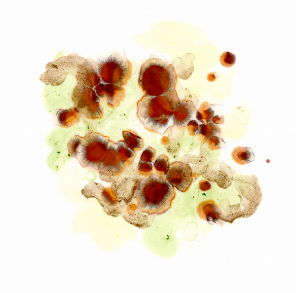 Image of a soil chromatograph with yellow and brown patterns.